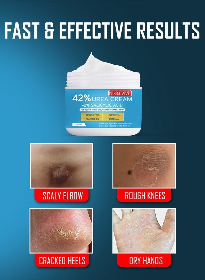 NIKITA.VIVI كريم يوريا 150 جرام 42% مع حمض الساليسيليك لعلاج تشققات القدمين واليدين وإزالة الكالو وكريم اليدين وكريم القدمين لتشققات كعب القدم والمرفقين والأظافر والركب ومرطب البشرة مع أقصى قوة - Image 3